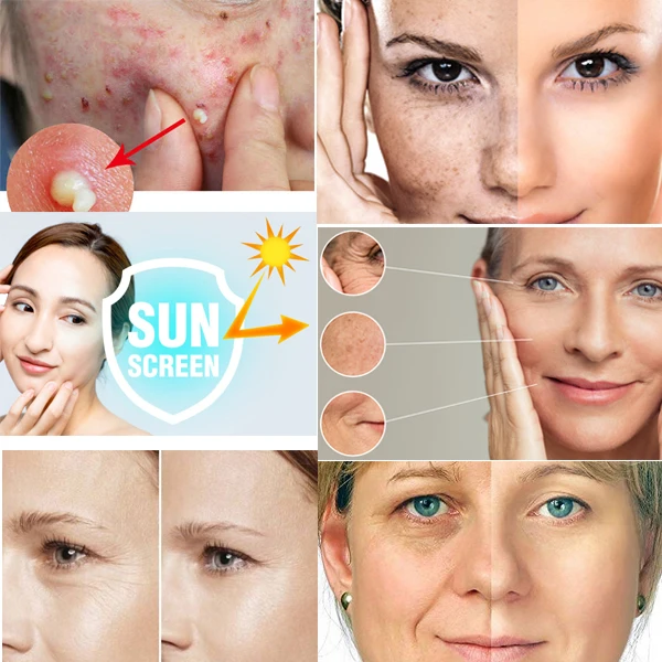 Cosmetics Grade Peptide SOD Powder Superoxide Dismutase