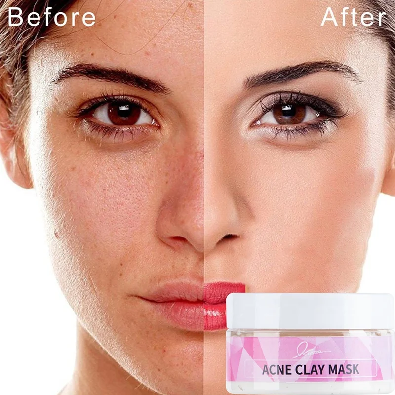 Factory Custom Natural Organic Kaolin Face Skin Care Mud Mask Deep Cleansing Oil Control Anti Acne Clay Mask