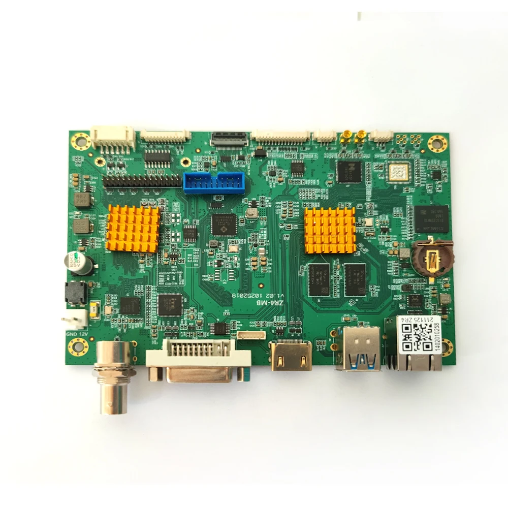 ENT Endoscope Camera 4K Module Built-in Work Station 1/1.8 inch High Definition Endoscopy System