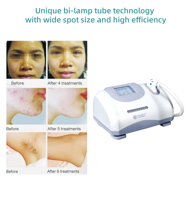 Professional Medical Furniture Facial Tools IPL Spevy Skin Care Machine Other Laser Multi-Functional Beauty Salon Equipment