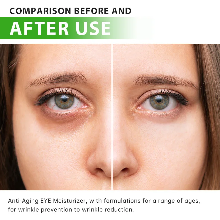 OBY Drop Shipping Collagen Eye Cream Anti-Aging Wrinkle Cream In The Eyes Moisturizing Firming Lightening Dark Circle Eye Cream