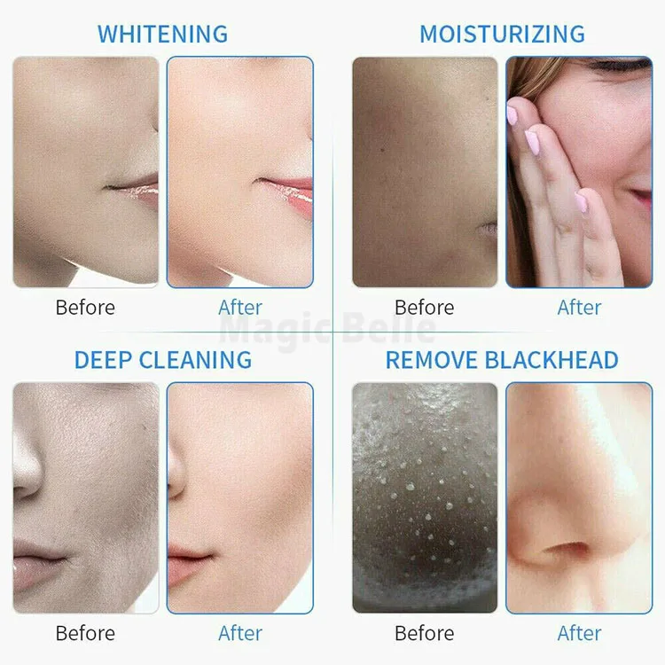 Oxygen Hydro Aqua Spray Jet Water Peeling Therapy Facial Lifting Hydra Dermabrasion Machine