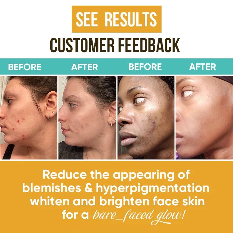 organic turmeric cream Anti-acne Moisturizing Herbal turmeric extract  Whitening Face  Cream