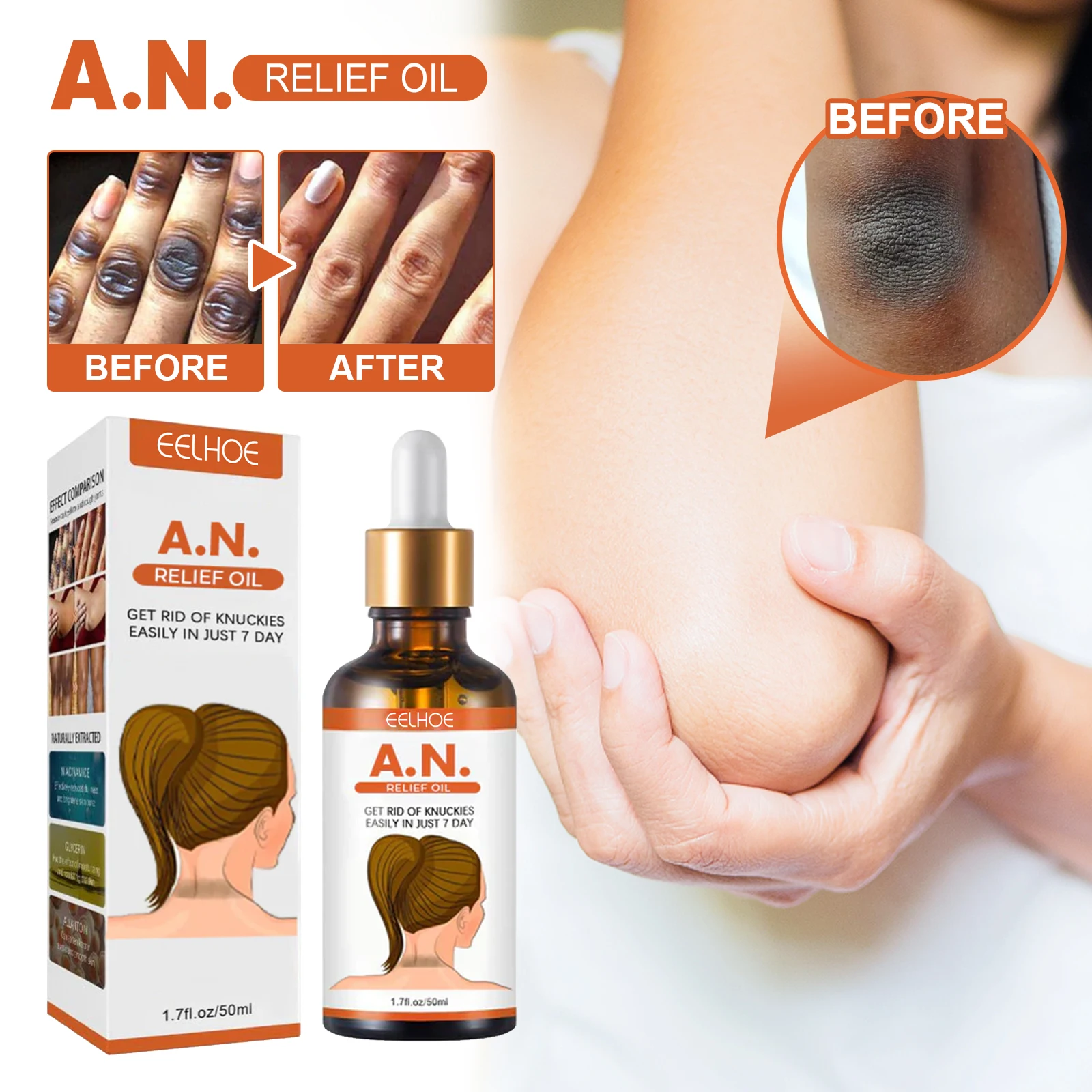 EELHOE Blackening And Brightening Whitening Essence Oil Improve Joint Dullness Body Care Gentle Exfoliating A.N. Relief Oil
