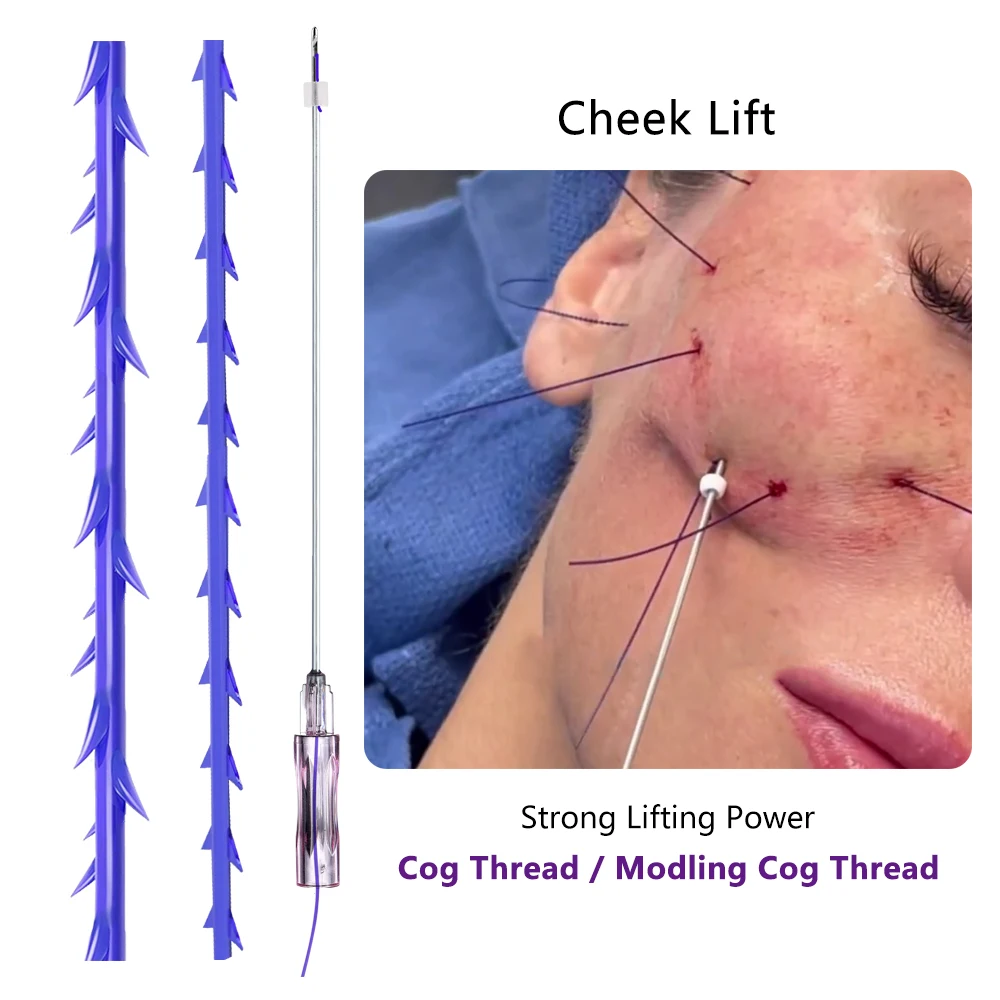Ce Approval Absorbable 19g 120mm Neck Face Lifting Hilos Tensores Pcl Thread 3d 4d 6d Pdo Cog Threads