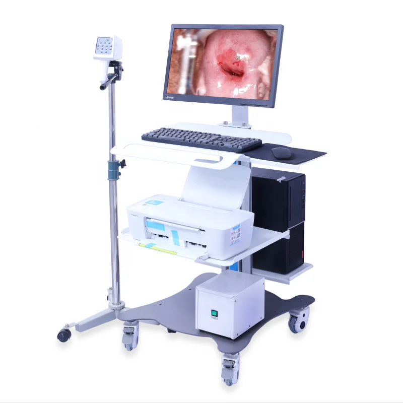 Colposcope Portable Video Digital Colposcope Imaging System Vagina Examination Colposcope For Gynecology