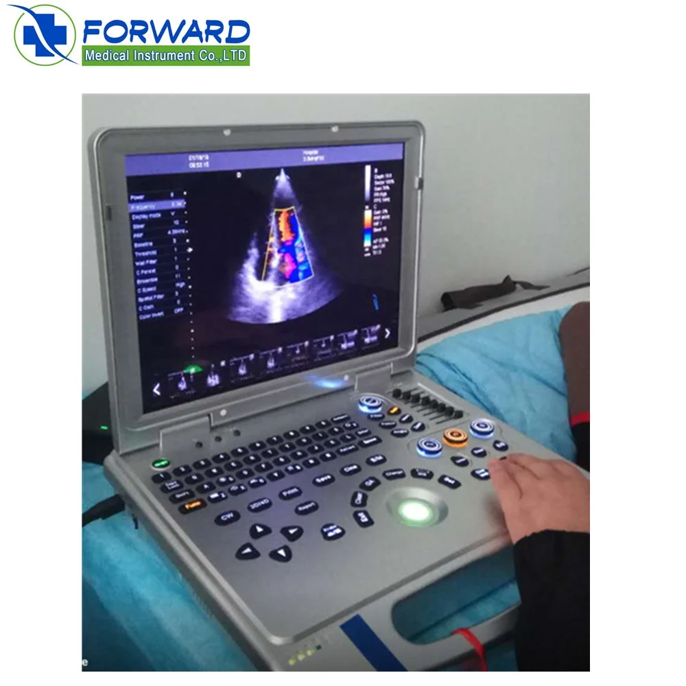 4D laptop portable color doppler ultrasound machine for human