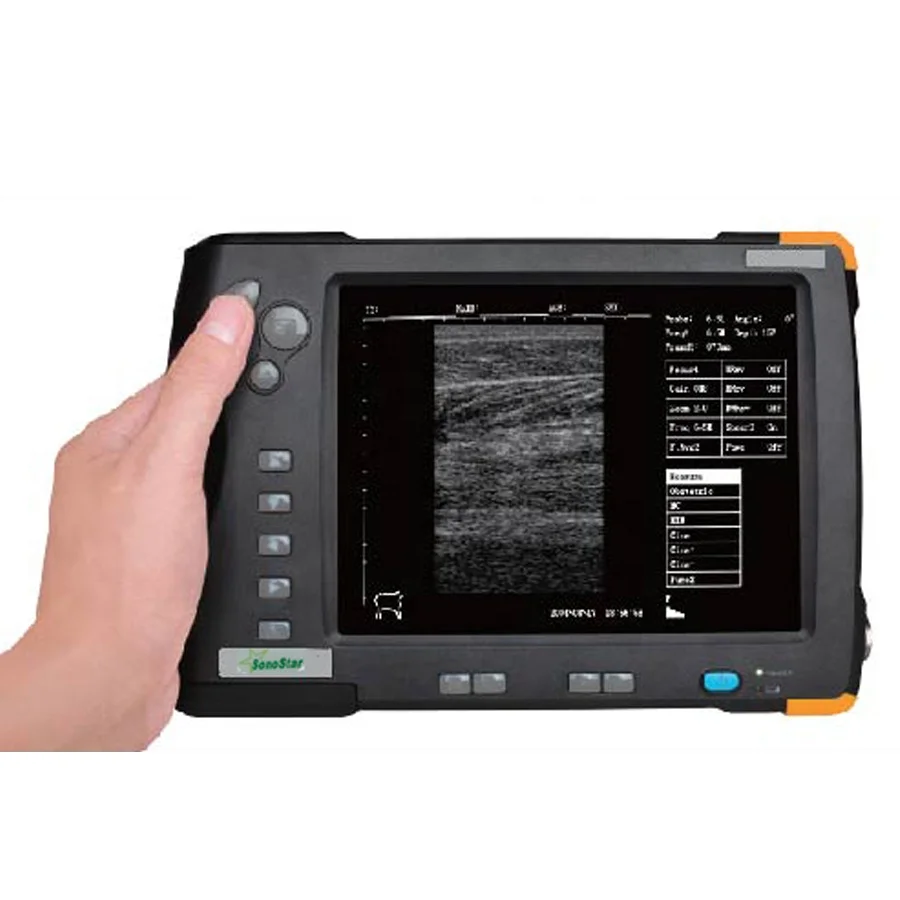 
Palm Handheld Veterinary Ultrasound Scanner Human or Vet Use Ultrasound Machine V5 Model 