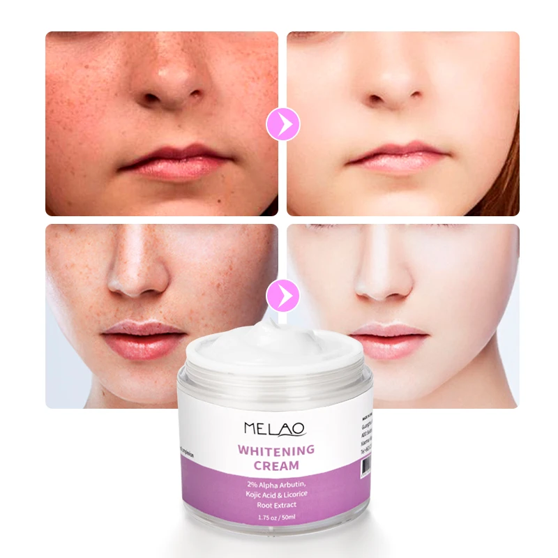 Korean Best Whitening Day And Night Dark Knees And Elbows Strong Whitening Cream
