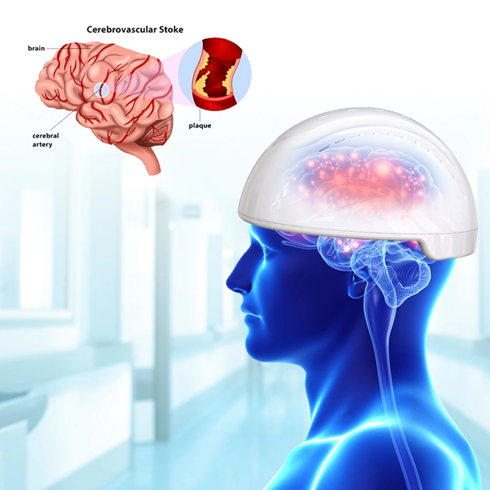 Suyzeko Degenerative Brain Health Care PBM Infrared Nerve Stimulation Helmet 810nm Phsical Therapy Infrared Light Helmet