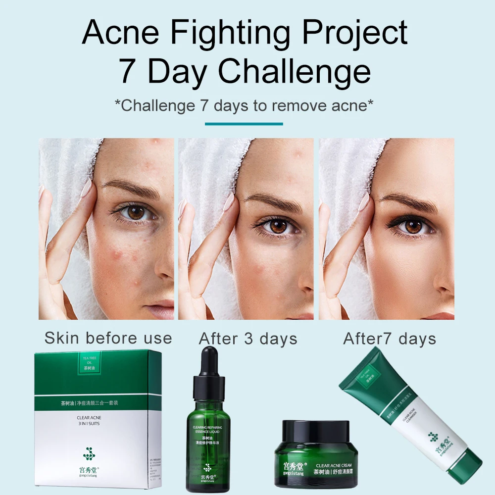 Acne Remover  Moisturizing Cleansing Pimple Tea Tree Oil Acne Remove Kit Acne Serum Cream Cleanser Skin Care Set