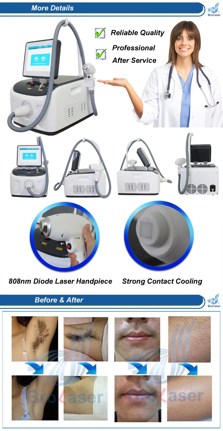diode laser