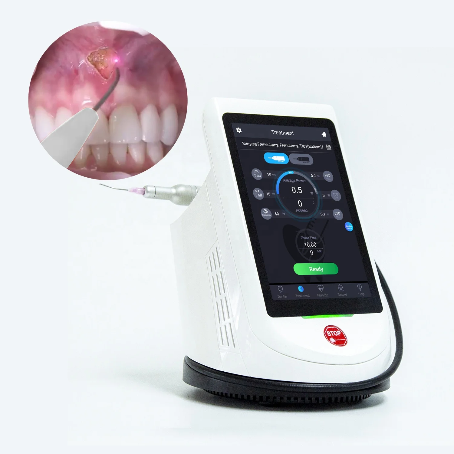 2023 latest medical dental laser 450nm 650nm 980nm tri-wavelength dental diode laser device