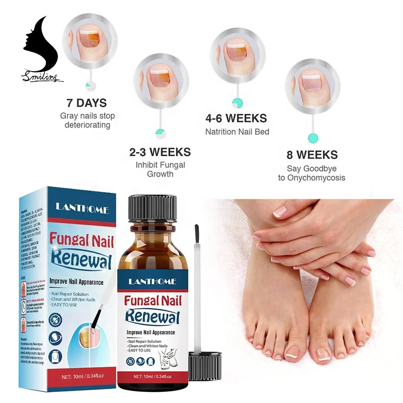 
Fungus Infection Treatment Foot Fungus Nail Solution Ingrown Toe Nail Fungal Repair Treatment 