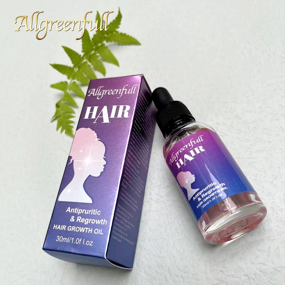 Free Sample Super Fast Hair Growth Serum Tonic Hair Growth Product Hair Growth Oil 30ML