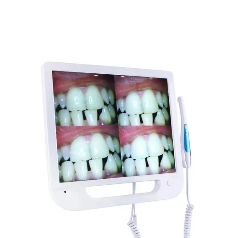 Newest Economic Wireless with 17inch Screen Monitor Holder Dental Chair Intraoral Camera