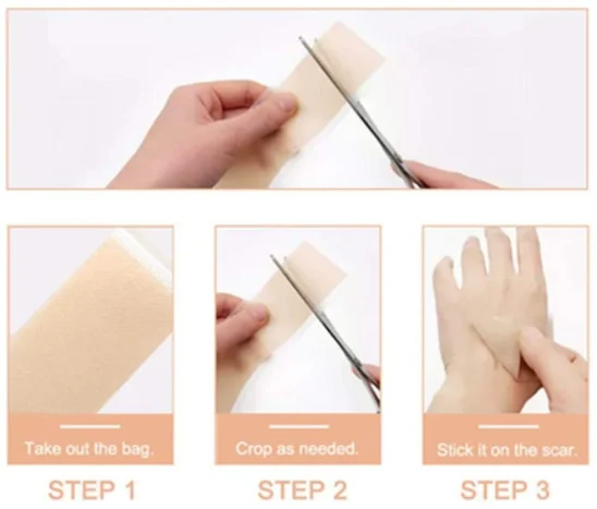 OEM Multi-color Scar Removal Private Label Skin Care Plaster Pink Blue Tape Silicone Scar Sheet
