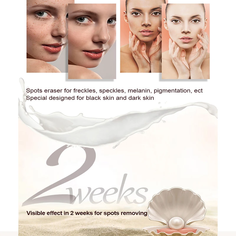 Herbal Face Anti Dark Spot Orient Golden Pearl Royal Expert Whitening Cream Pakistan