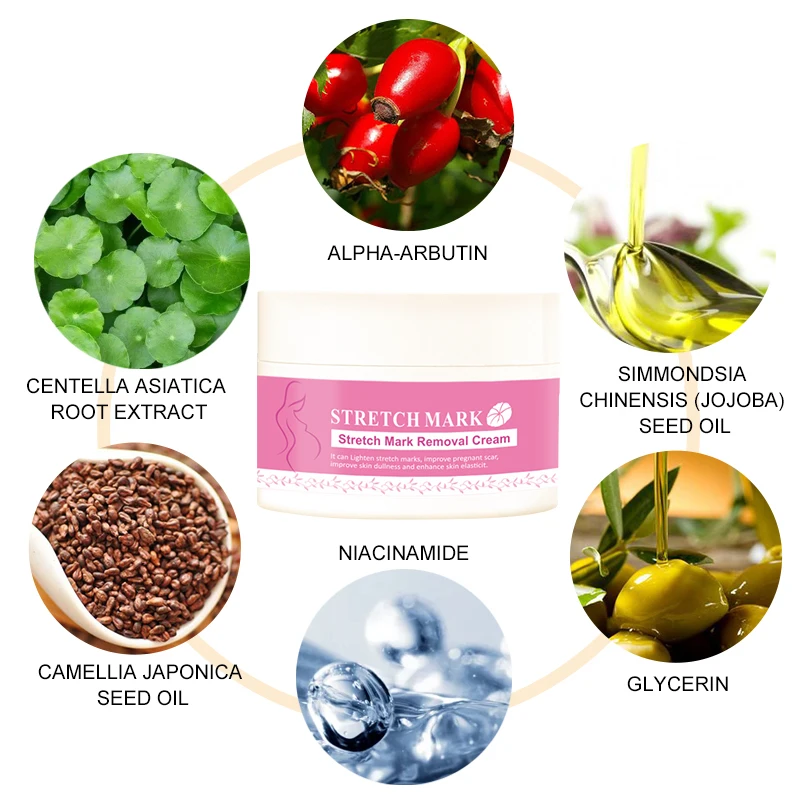 Private label stretch mark cream Eliminate stretch marks in one week Natural and organic asiaticoside stretch mark cream