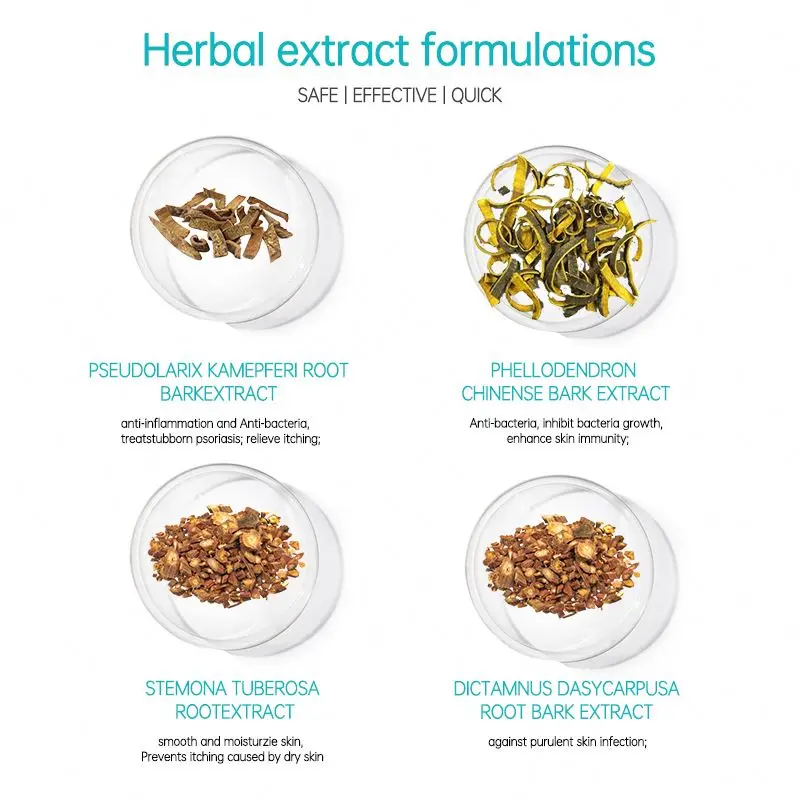 New Arrival Health Care For Psoriasis Treatment Effectively Herbal Cream Topical Ointment For Psoriasis Body Care