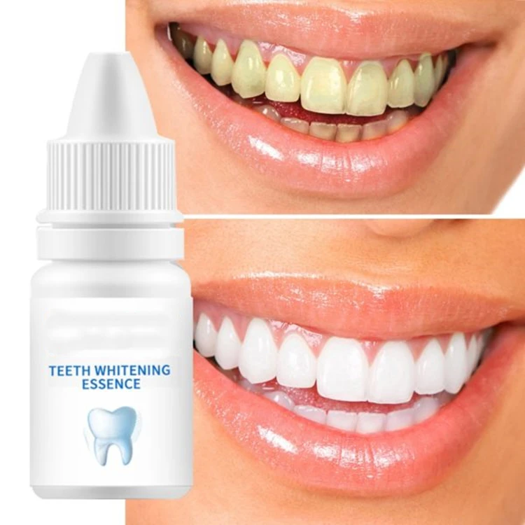 Most Popular Teeth Whitening  Fast Result Whiten Bleach Tooth  Private Label