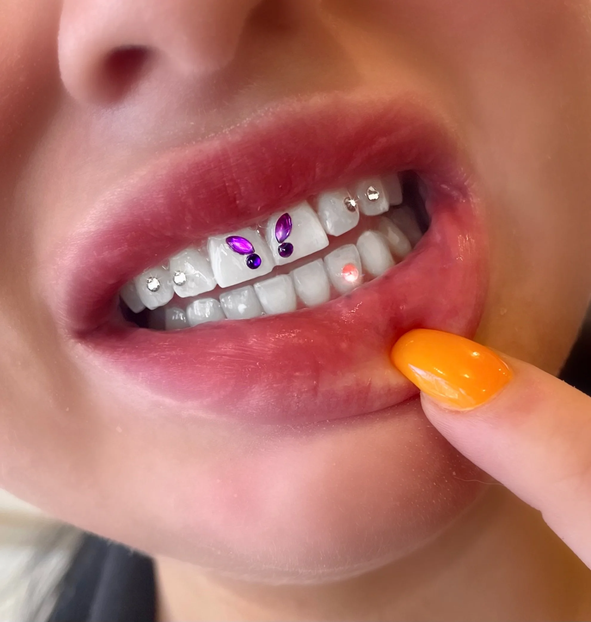 Beauty Diamond Butterfly Dental Crystal Tooth Jewelry Ornaments Crystals Stone Tooth Gem Gorgeous Smile