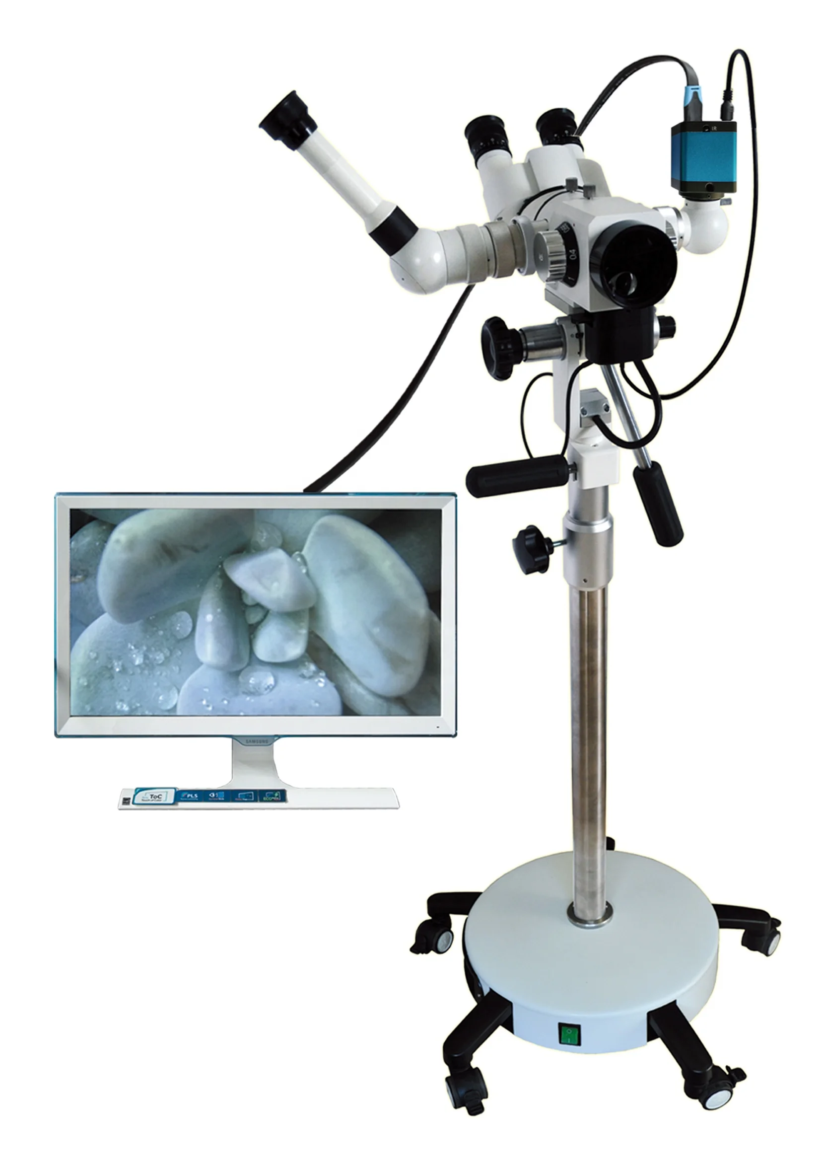 Лучший дешевый цифровой колпоскоп для гинекологии