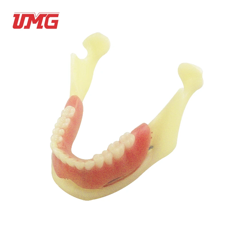 Resin Mandibular Detachable Jaw Bone Denture Model with Belt Nerve and Teeth