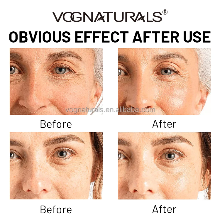 Private Label OEM Anti Aging Moisturizer Vitamin E Collagen Day and Night Caviar Face Cream