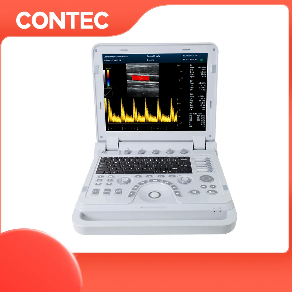 CONTEC 1700A Professional Sonography Echocardiography Vascular Ultrasound