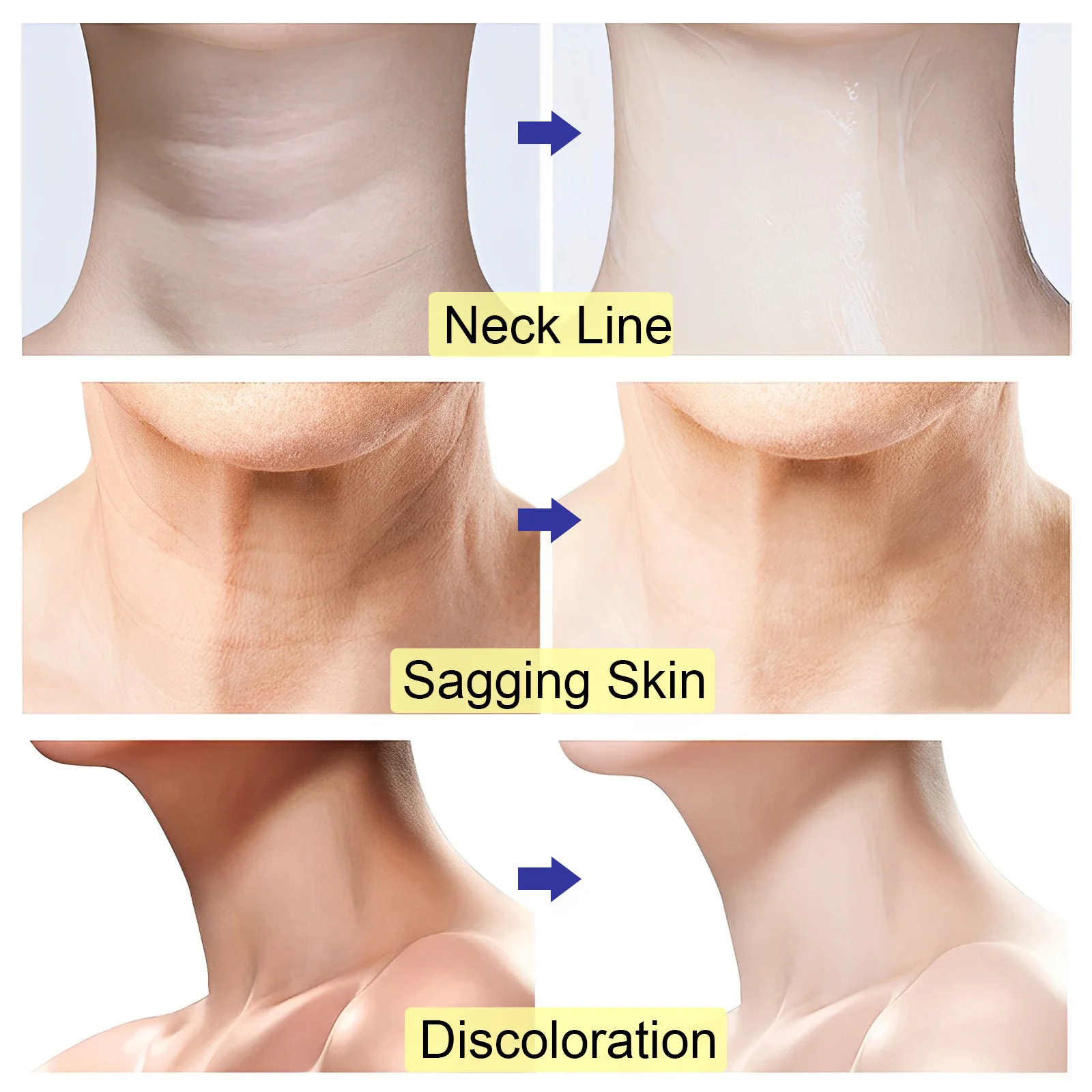 Private Label Natural Organic Vegan Neck Lightening Cream Anti Wrinkle and Saggy Firming Neck Cream for Double Chin