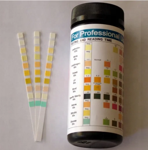 14 parameters urine test strip