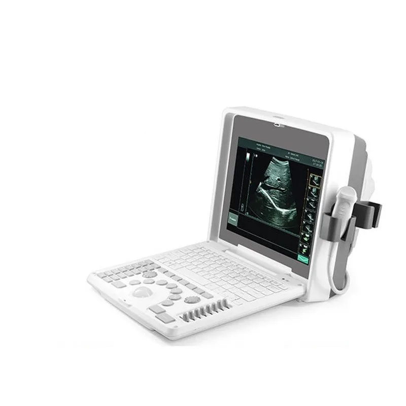 15 Inch LED Display Portable Veterinary Ultrasound Equipment Color Doppler Ultrasound for cows, Horses, Pigs