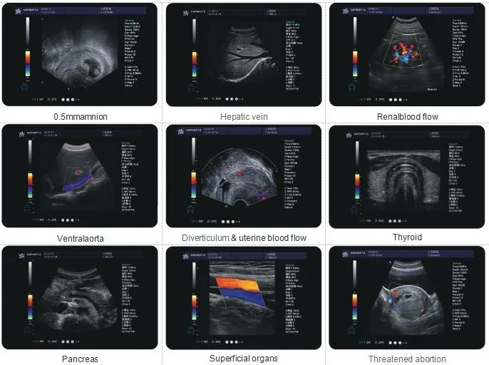 Best quality Medical Ultrasound Instruments Portable Color  Doppler 3d Ultrasound machine for hospital for sale