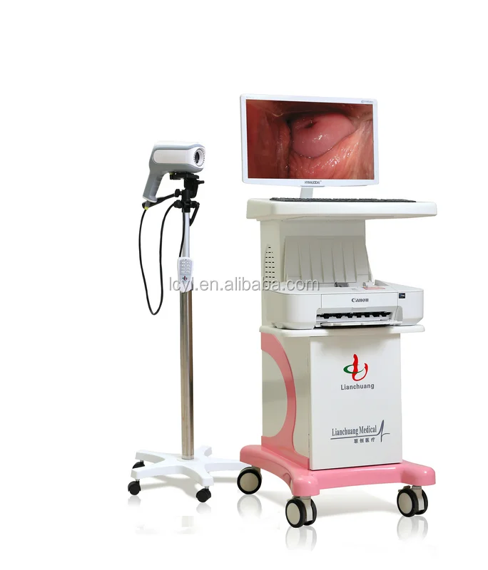 Hospital professional Medical System Specialized Digital Optical Colposcope