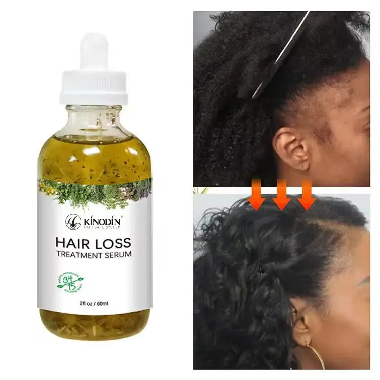 African All Natural Hair Treatment Products Miracle Rosemary Mint Hair Growth Oil Serum for African Hair Natural Babies