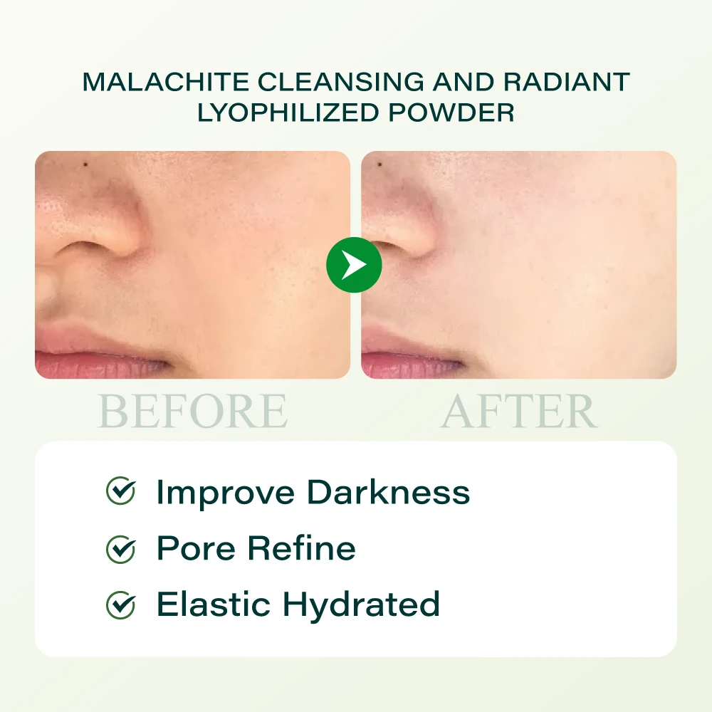 High-end Anti-aging Serum Skincare Beauty Moisturizer Skin Care Product Oligopeptide-1 Nicotinamide Lyophilized Powder For Women