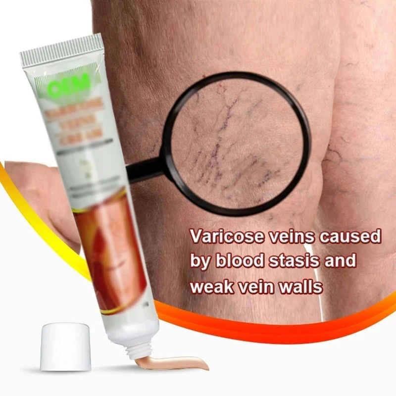 Oem Genital Scrotum Varicocele Varicose Veins Cream Varicosity Angiitis Phlebitis Leg Veins Pain Ointment