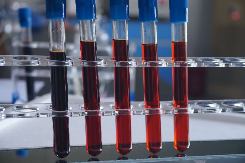 
Best quality krill oil capsule from China 