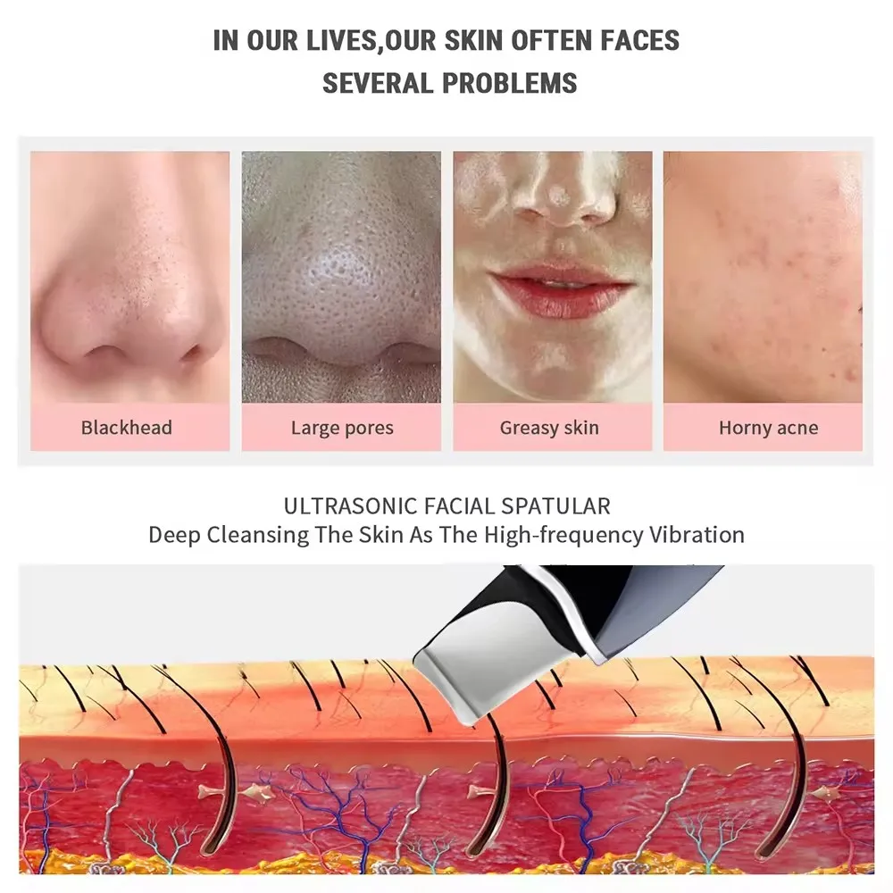 New Ultrasonic scrubber Deep cleansing Face scrubber Cleansing spade Exfoliating scraper Peeling beauty instrument