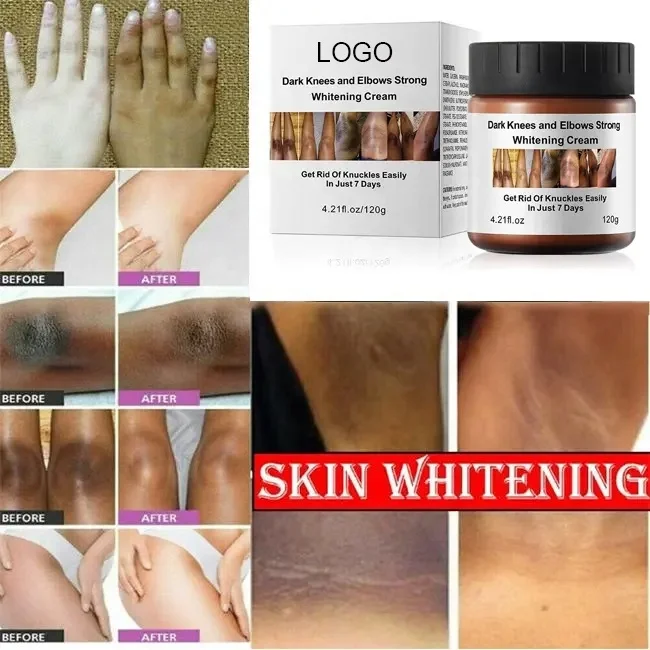 OEM ODM Organic Body Care Product Dark Knees And Elbows Strong Whitening Cream Customized Private Logo