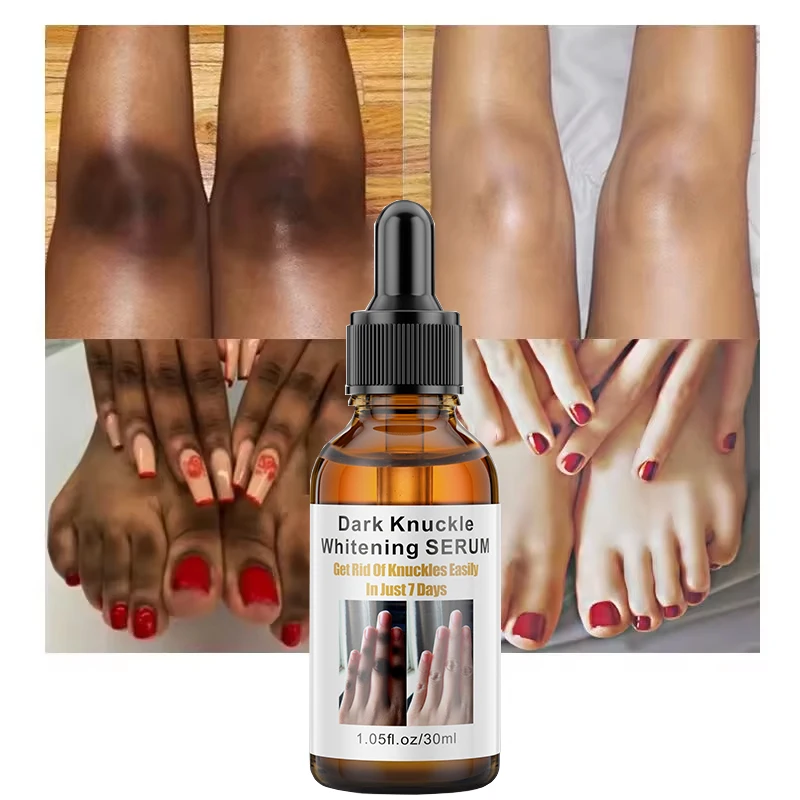OEM Private Label Dark Knuckles Fast Whitening Serum Hand Knuckle Elbows Knee Intense Stains Remover Serum