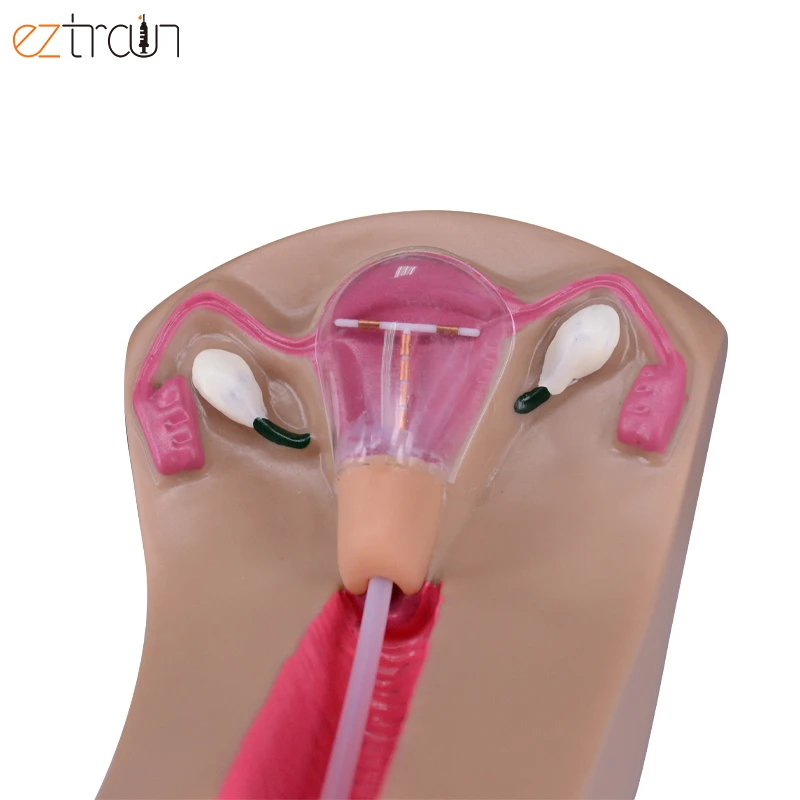 IUD тренировочный симулятор анатомии матки яичников модель для тренировки внутриматочных