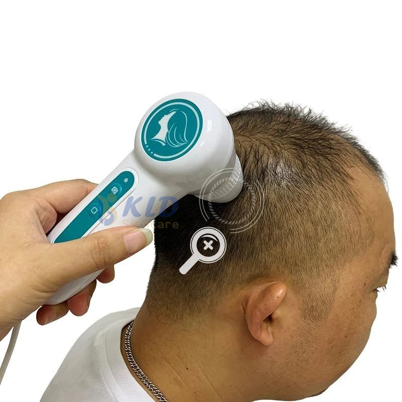 Hair Regrowth Scalp Treatment Machine with Hair Follicle Detection Analysis Anti-hair Loss Treatment Scalp Massager
