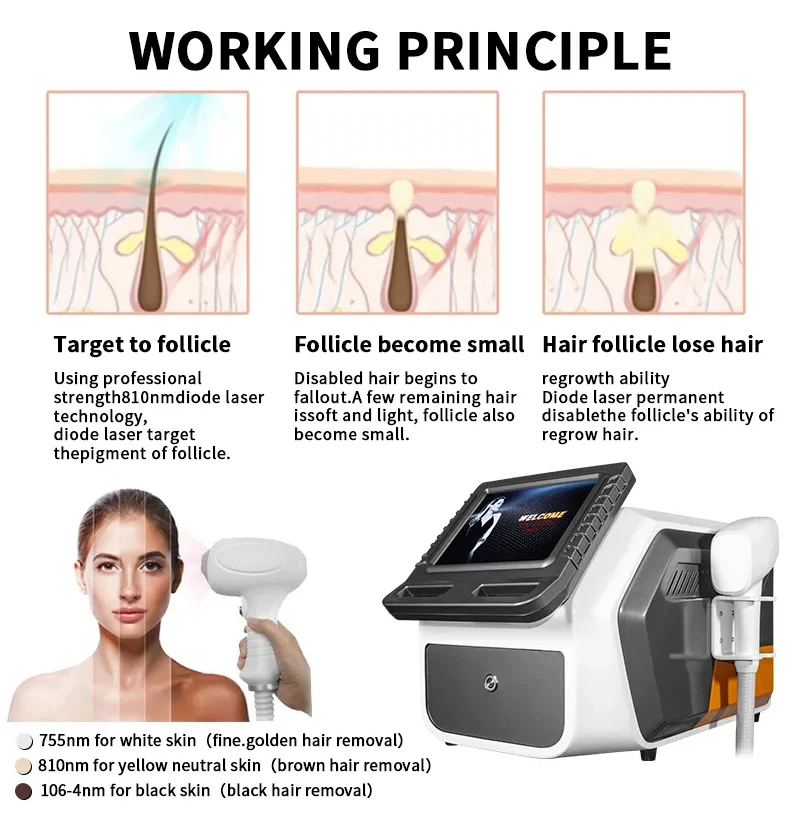 Alexandrite laser Epilator Ice Platinum Diode Laser 755 810 1064 Deka Laser Alexandrite Permanent Hair Remover