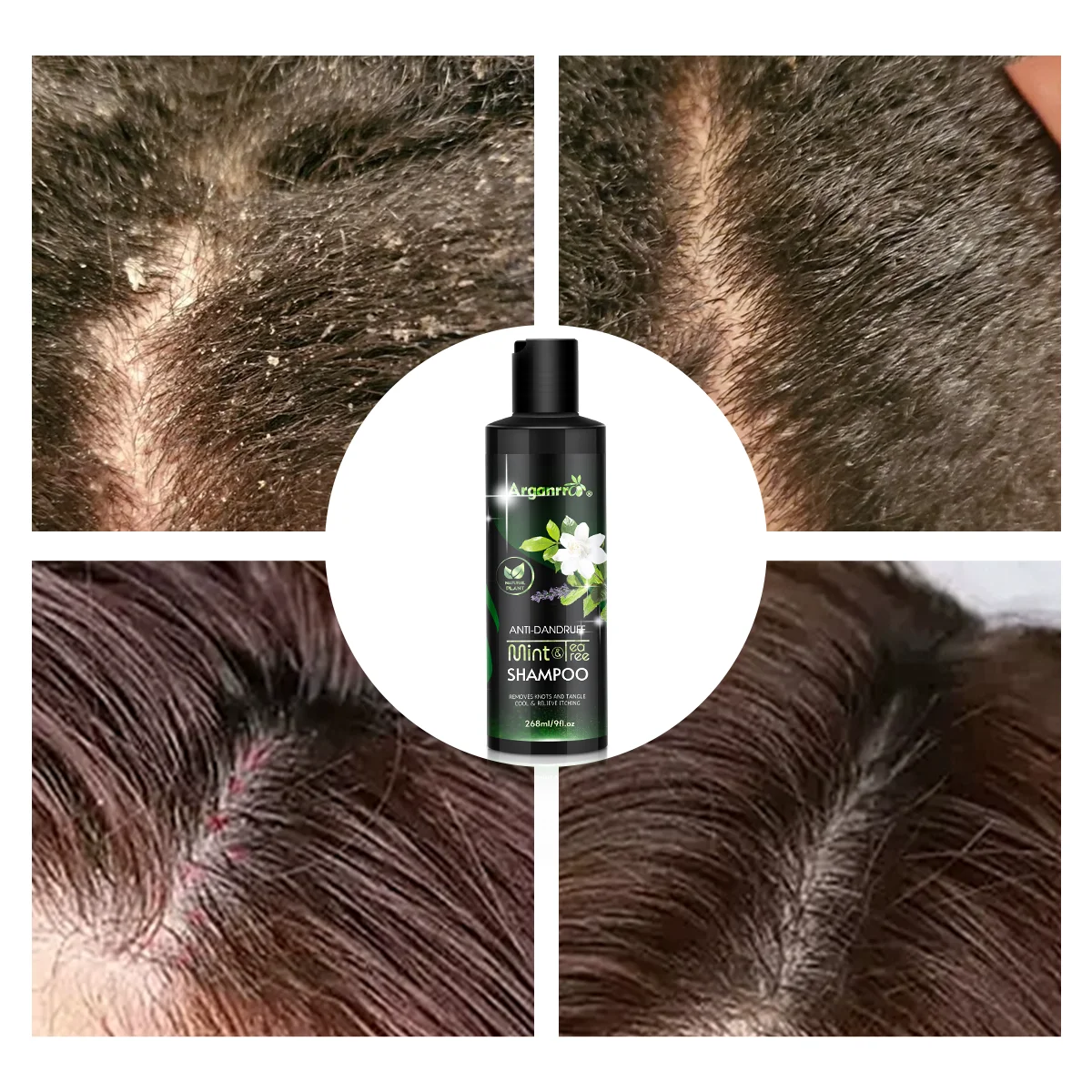 Love Yourself Hair Care Set Relieve Itching Improve Scalp Healthy Mint TeaTree Shampoo And Conditioner