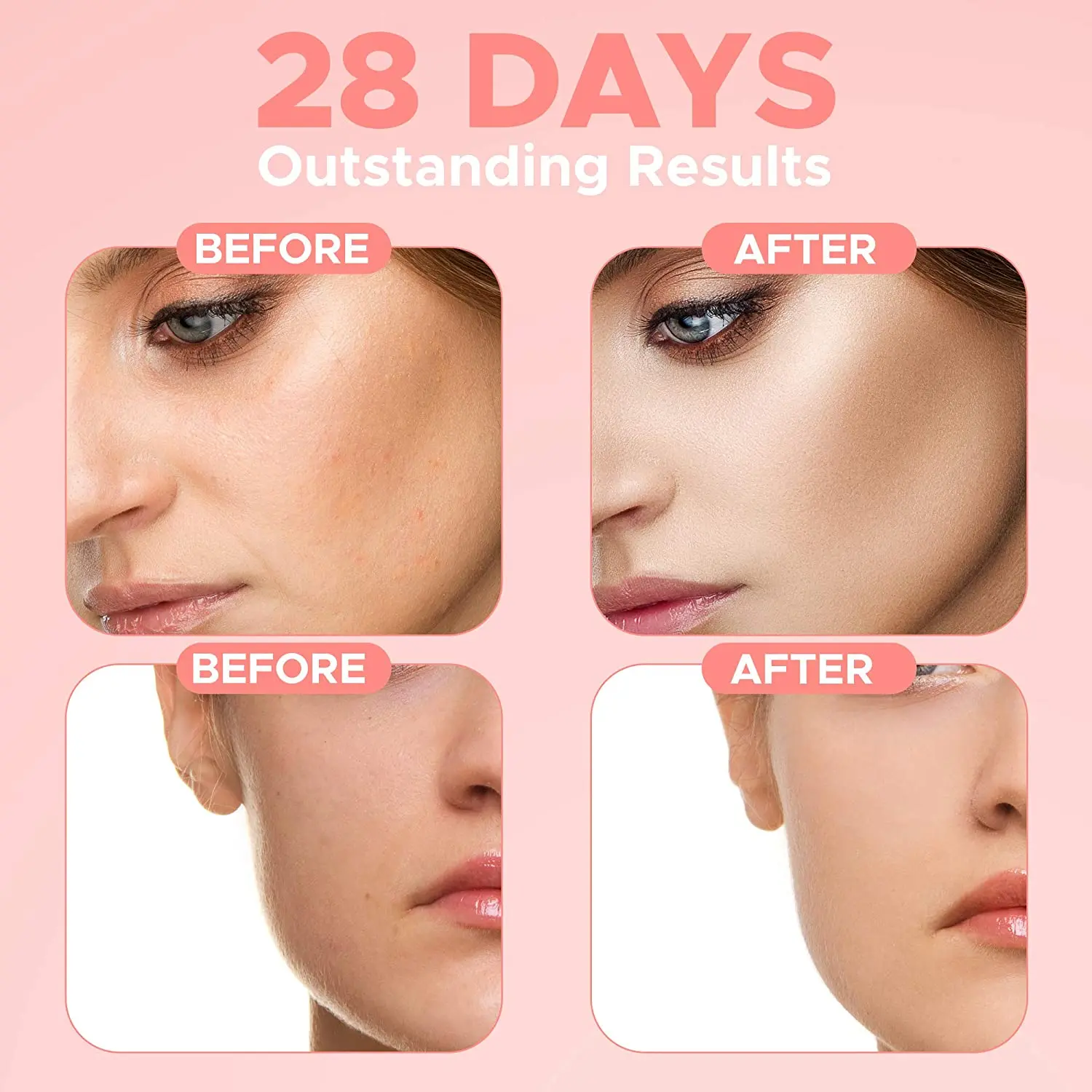 Custom Label Face Serum 4 in 1 Whitening Anti Age Face Serum with 30% Vitamin C 5% Niacinamide 10% Vitamin E Serum