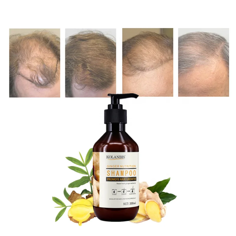 Top Ten Private Label Shampoo Manufacturer Cure Alopecia Treatment Herbal Hair Care Supplier