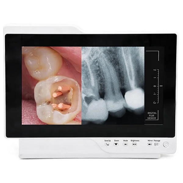 Digital Intraoral Endoscopy Camera With Monitor For Dental Chair Dental Inter Oral Endoscopy