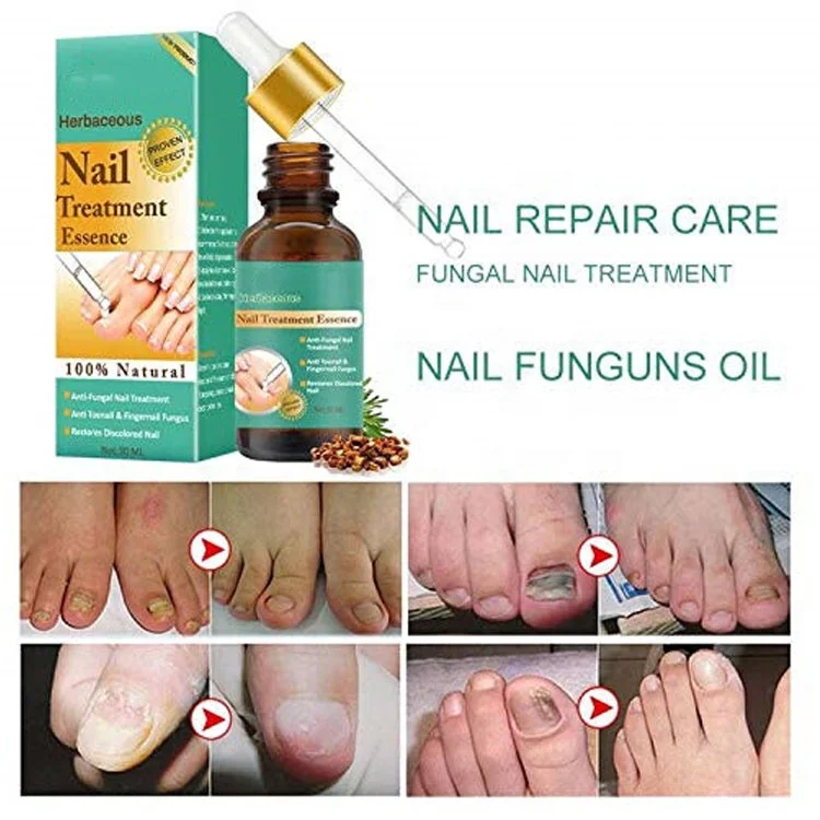 OEM Anti Fungal Treatment Finger Gel Beauty Care Nail